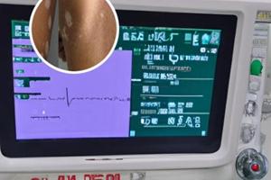 胸腺肽针剂作用
